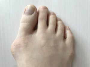 足の指でパーが出来ないと鼻緒が食い込んで痛みます